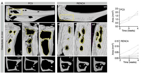 Simulazione della progressione osteolitica all’interno di A(BM)². A. Osteolisi indotta dal tumore, in vivo, analizzata tramite µCT; sono riportate immagini della progressione nel tempo e la quantificazione dell’area ossea riassorbita (lesioni singole, n = 3–7 lesioni/osso).