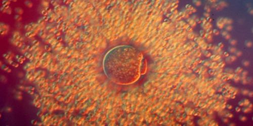 Ingrandimento al microscopio di un oocita