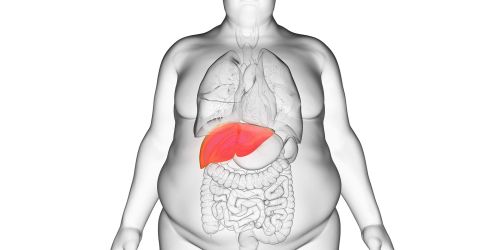 Disegno di busto umano in persona obesa con organi interni e fegato evidenziato in rosso