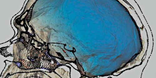 Ricostruzioni digitali del cranio e del volto