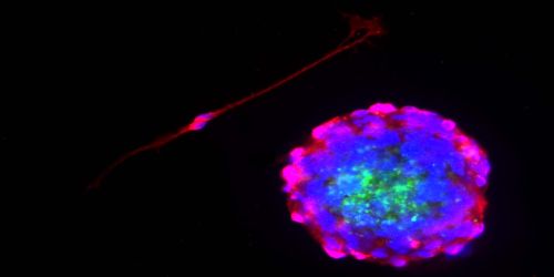 Vista al microscopio a fluorescenza di campioni cellulari in toni di blu, magenta e verde fluorescente su uno sfondo scuro