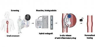 Disegni descrittivi relativi al progetto EPEIUS