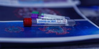 Provette per test Covid appoggiate su fogli con riproduzione della struttura del virus