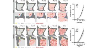 C, D. Simulazione dell’osteolisi in A(BM)²; sono riportati frame rappresentativi e quantificazioni; rettangolo tratteggiato, ingrandimento. Frecce nere, aree di riassorbimento; indiv sim, simulazione individuale; aver, media.