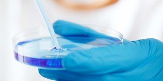 Dettaglio su piastra di Petri tenuta da mano con guanto