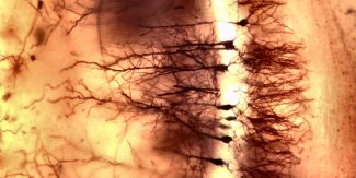 Rappresentazione di cellule nervose nella regione CA2 della formazione ippocampale di topo dopo colorazione di Golgi di campioni inclusi in paraffina. Ingrandimento: 40×.