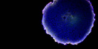 Vista al microscopio a fluorescenza di una struttura cellulare sferica dai toni blu e viola intensi su fondo nero.