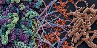 Microscopia elettronica a scansione a colori del microbioma